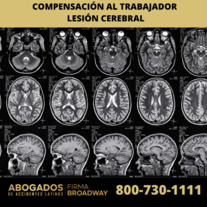 Compensación al Trabajador por Lesión Cerebral